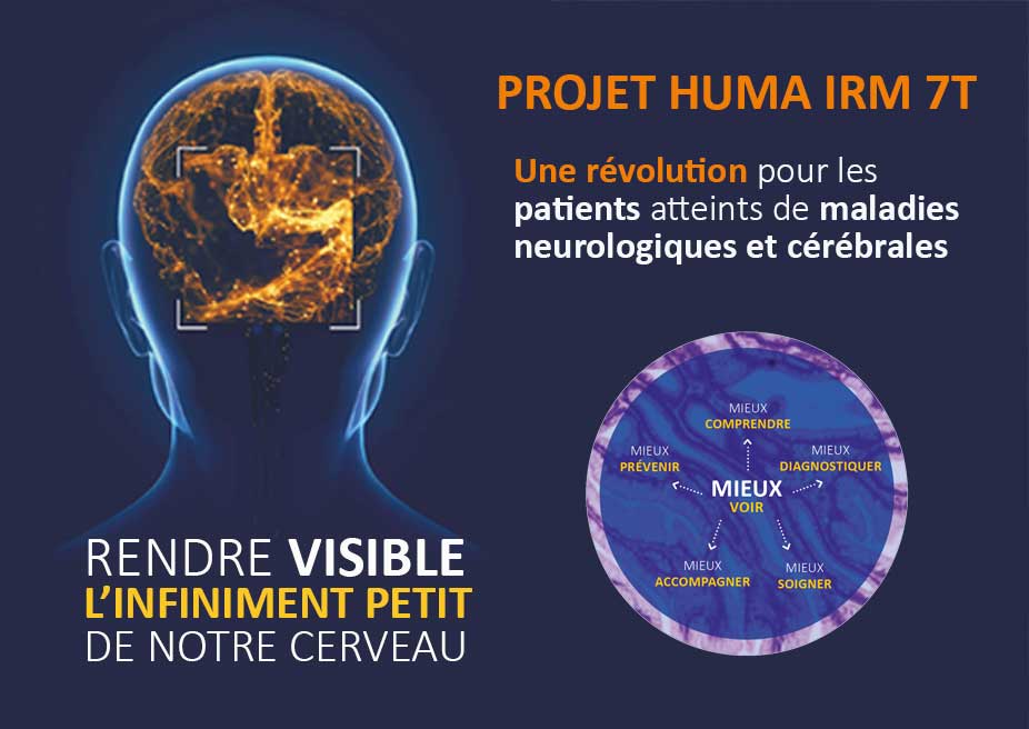 Projet Huma IRM 7T - Visuel Actu
